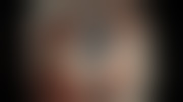 Dynamic clip and band countertraction in ESD