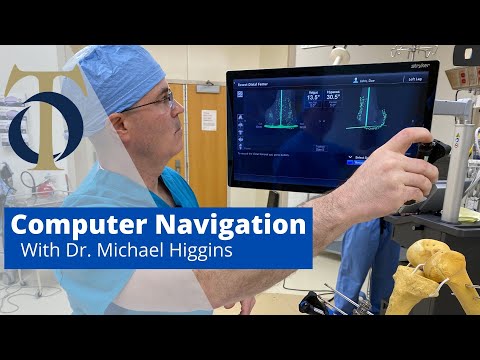 Computer Navigation for Ready Knee Procedure with Dr. Michael Higgins