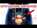 Опущение внутренних органов. Висцероптоз.