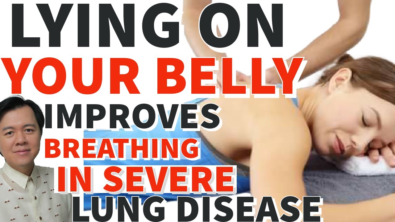 Lying on Your Belly Improves Breathing in Severe Lung Disease YouTube