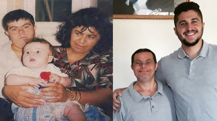 Suo padre è affetto da sindrome di Down, ecco come è diventato il figlio oggi...