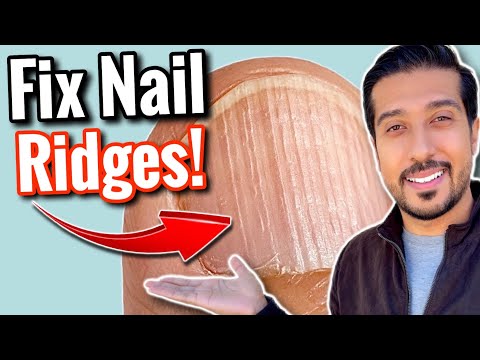 Vertical Ridges on Nails | What Are Your NAILS Trying to Say? - YouTube
