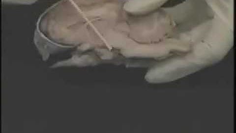 BrainU Sheep Brain Dissection - Part 1