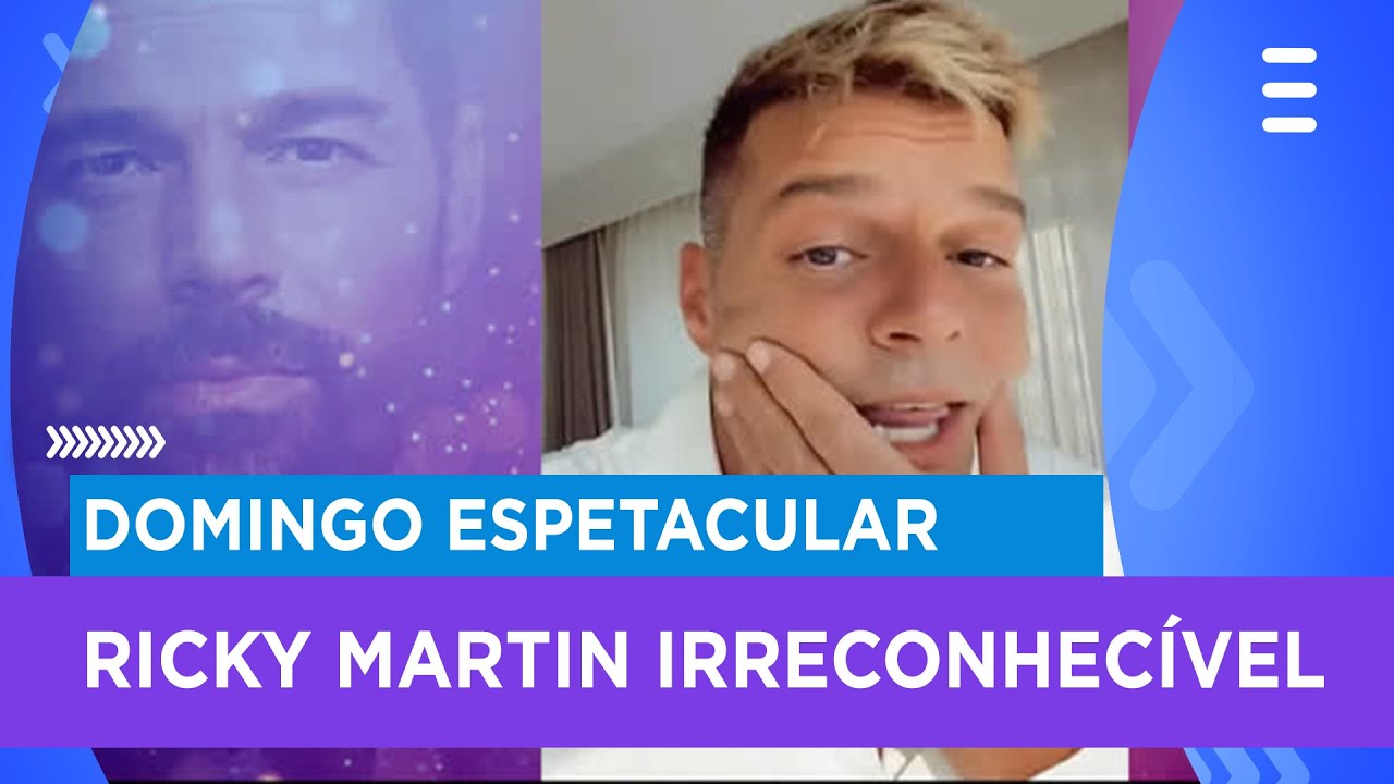 Mudança no rosto de Ricky Martin chama a atenção de fãs do mundo todo