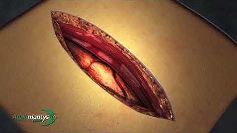 aquamantys transcollation animation video