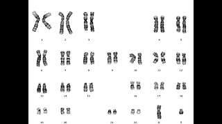 Karyotyping- Human chromosome identification/easiest way of making Karyogram/Cytogenetic analysis