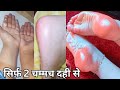 DIY *Face-Glow* Challenge| सिर्फ एक बार में पाएं Tight,Glowing &amp; Young Skin| 100% Results in 3 days|