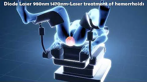 Laser Hemorrhoidoplasty (LHP) - IBI Healthcare Institute - DayDayNews