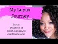 MY LUPUS STORY!  Part 1: How my Lupus was Diagnosed