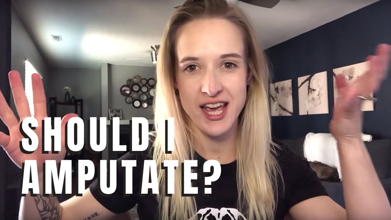 Will I Be Amputating My Leg?? Day of the decision... leg amputation recovery