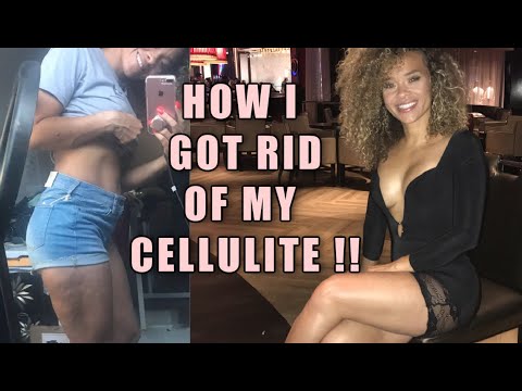 Come liberarsi della cellulite | aggiornato | Prova!