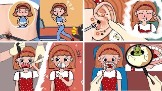 Asmr Remove Acne On Face And Dirt In Ears, Navel Animation Asmr Micha Channel