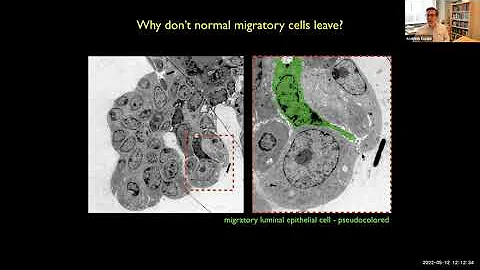 "Molecular and cellular mechanisms of breast cance...