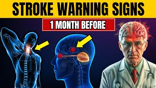 7 Silent Stroke Signs that Appear a Month Before Attack | (Doctor Warns)