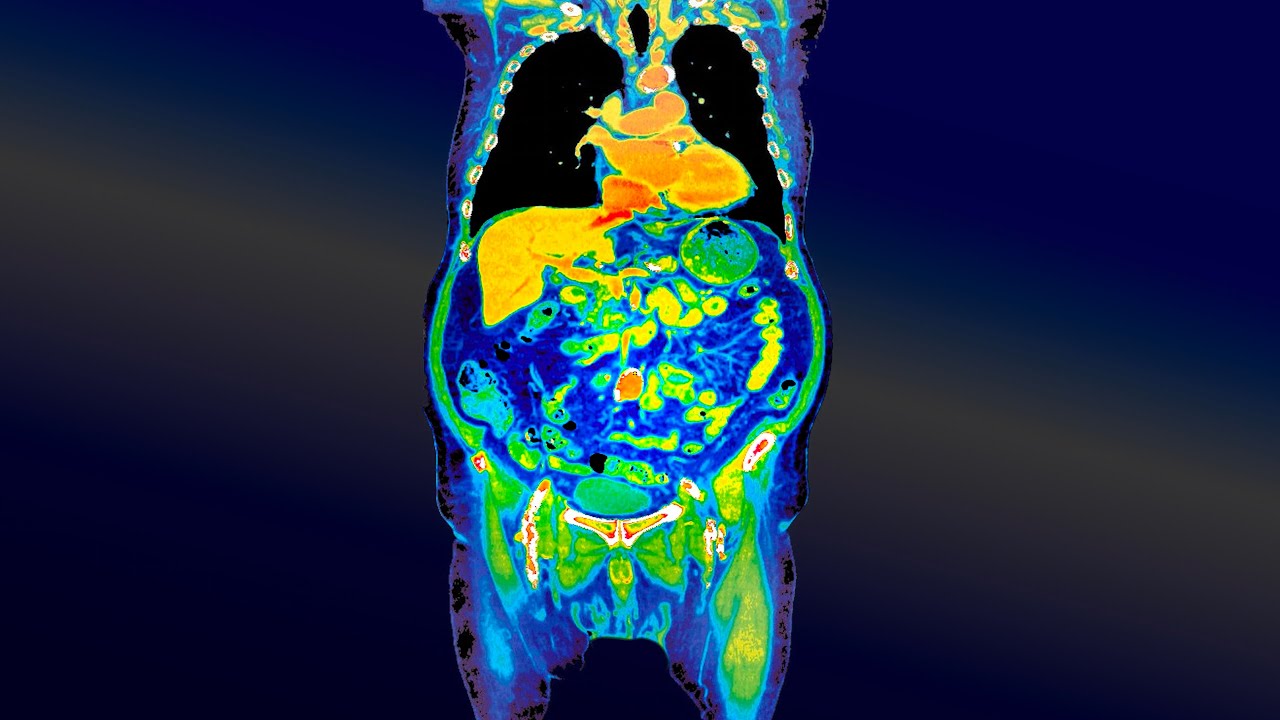 A Mom Ate Chicken Burrito From A Suspicious Restaurant. This Is What