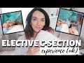 ELECTIVE C-SECTION STORY - HOW DID IT GO? | NHS 2019