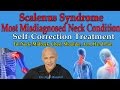 Scalenus Syndrome: The Most Misdiagnosed Neck Pain Condition (Corrective Exercises) - Dr Mandell
