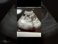 双子妊娠?!…アレ?心臓が、3つ?!?!となった我が家の話🤭 #3つ子 #赤ちゃん #ふたご #baby #育児 #fyp