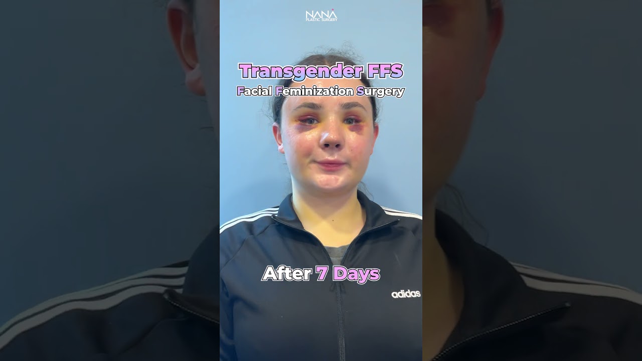 See a transgender's transformation ! #FFS 🌈🏳️‍⚧️