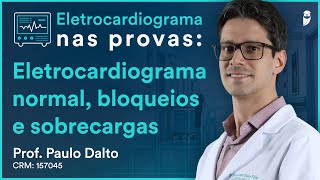 Eletrocardiograma normal, bloqueios e sobrecargas - Eletrocardiograma