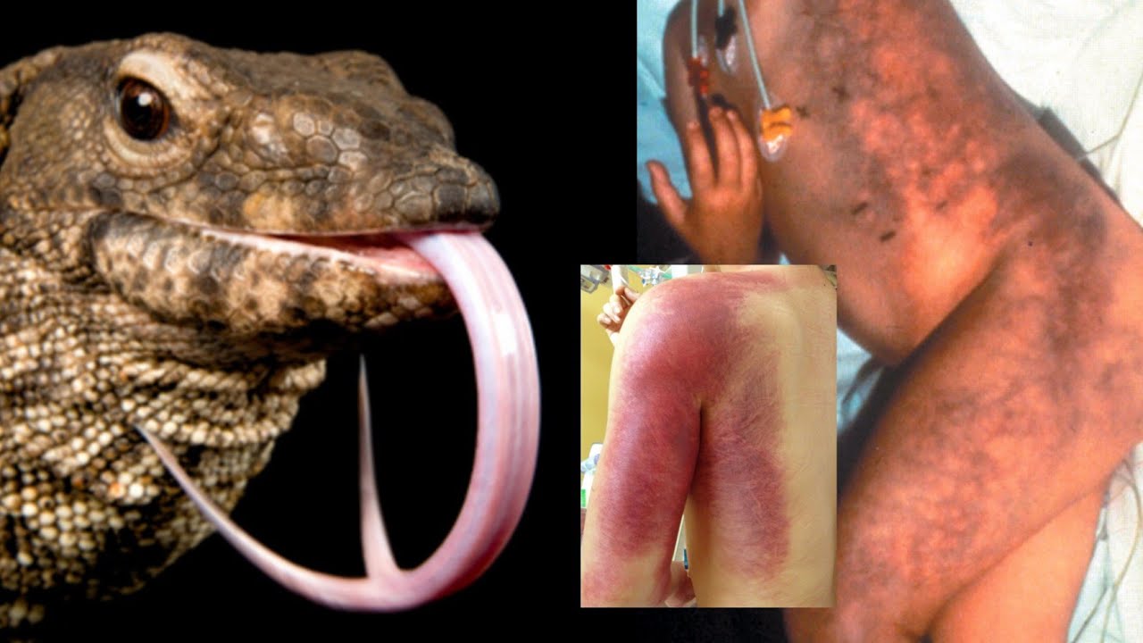 Eating Monitor Lizard Is Right Or Wrong eating-monitor-lizard-is-right-or-wrong