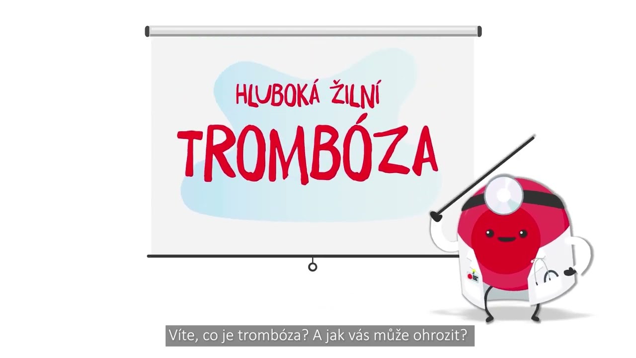 Jak vyzrát na trombózu a plicní embolii? Rozhýbejte krvinky!