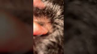 #asmrmassage #satisfying #ingrownhair #massagespa #viralvideo