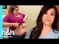 Enorme lipoma luce como un tercer seno | Dra. Sandra Lee: Especialista en piel | Discovery H&H