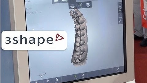 TRIOS® digital impression - 3shape