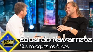 Eduardo Navarrete confiesa todos sus retoques estéticos  El Hormiguero