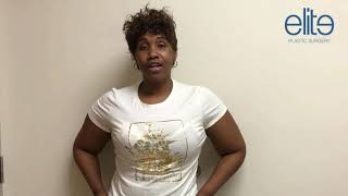 Patient Testimonial Leg Lift & Leg Lipo Moises Salama Md