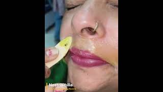 🐽 Indian Beauty Gets Her Upper Lip Hair Removed—While Her Flaring Nostrils Steal the Spotlight Vivi