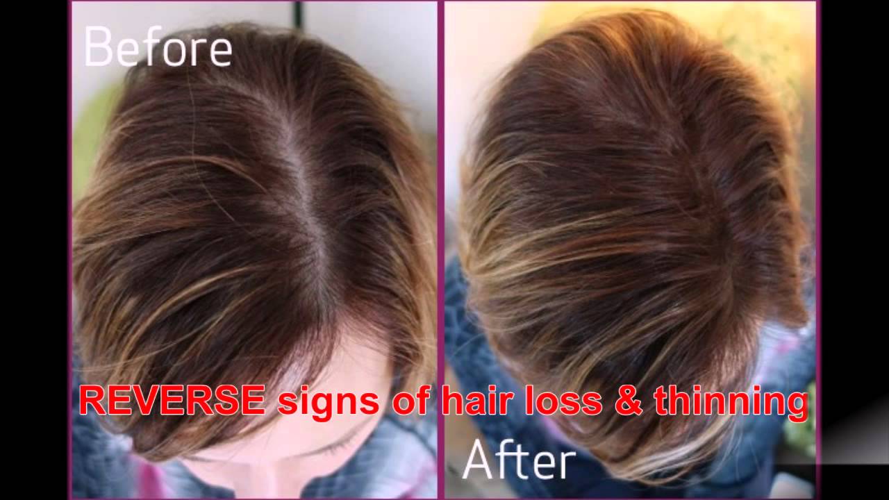 How do you reverse thinning hair?