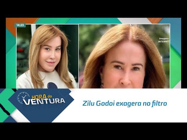 Zilu Godoi exagera no filtro e recebe onda de críticas 