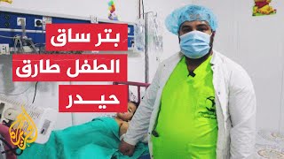 بعد بقائه 40 ساعة تحت الأنقاض.. الفريق الطبي يضطر لبتر ساق الطفل طارق حيدر