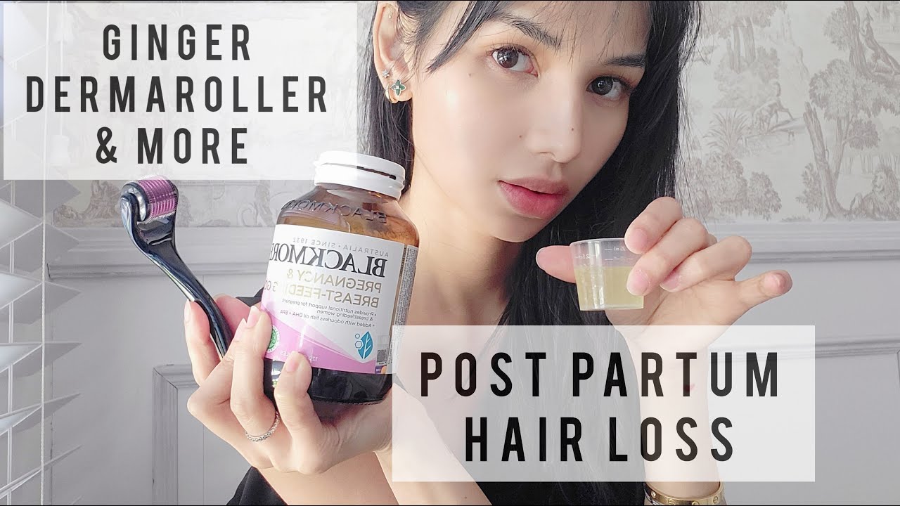 Postpartum hair loss tips for hair growth (dermaroller, ginger and