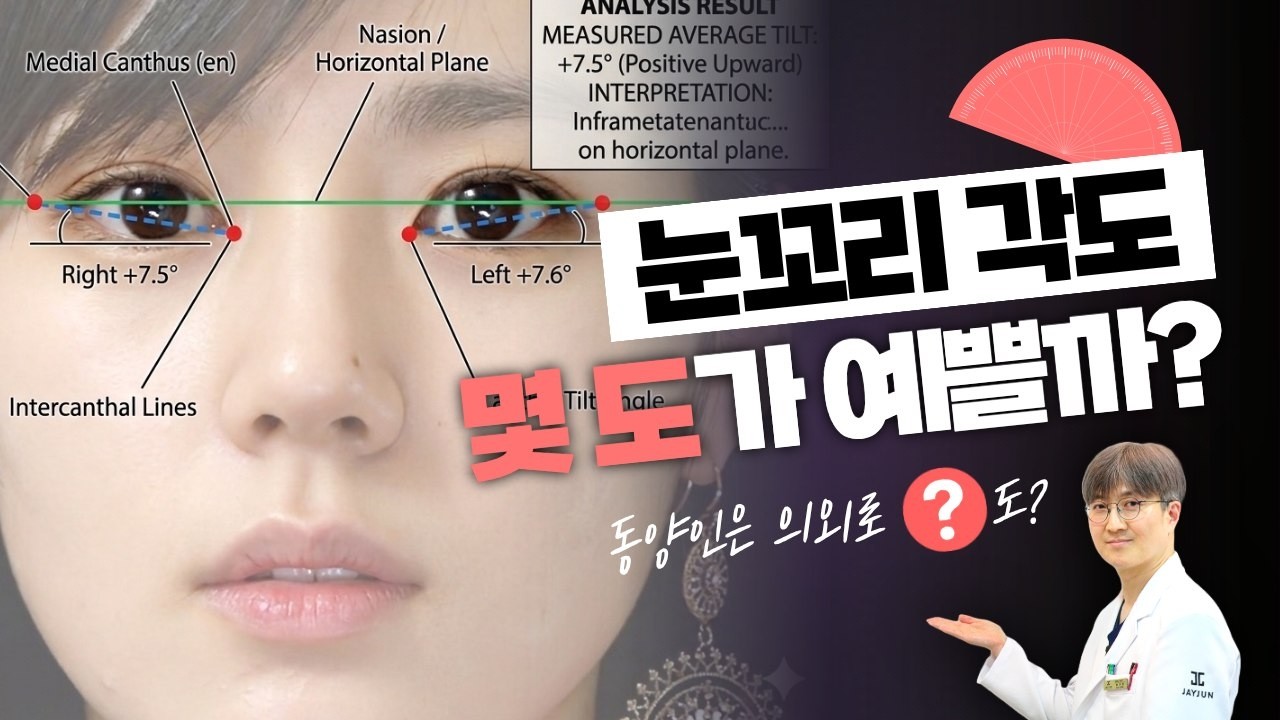 #눈수술 #눈꼬리 #눈꼬리각도 #예쁜눈 #뒤트임 #강아지상 #고양이상 #한가인 #하기영 #제이준성형외과#뒤트임 #눈꼬리성형 #눈성형