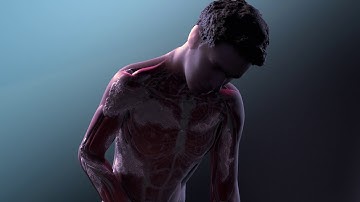 Ossificans Progressiva | MOA Animation