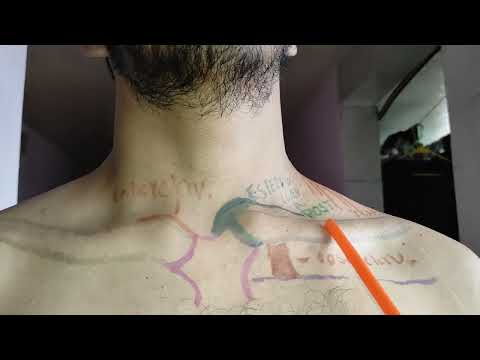 Articulación Esternocostoclavicular