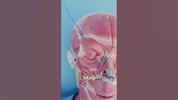 How An Eyebrow Thread Lift Works 🤔