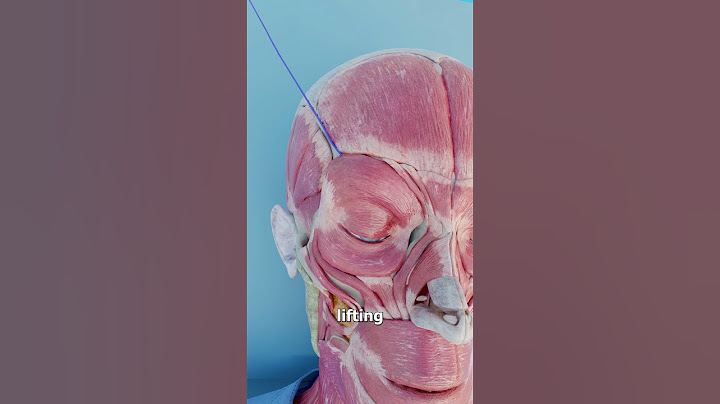 How An Eyebrow Thread Lift Works 🤔