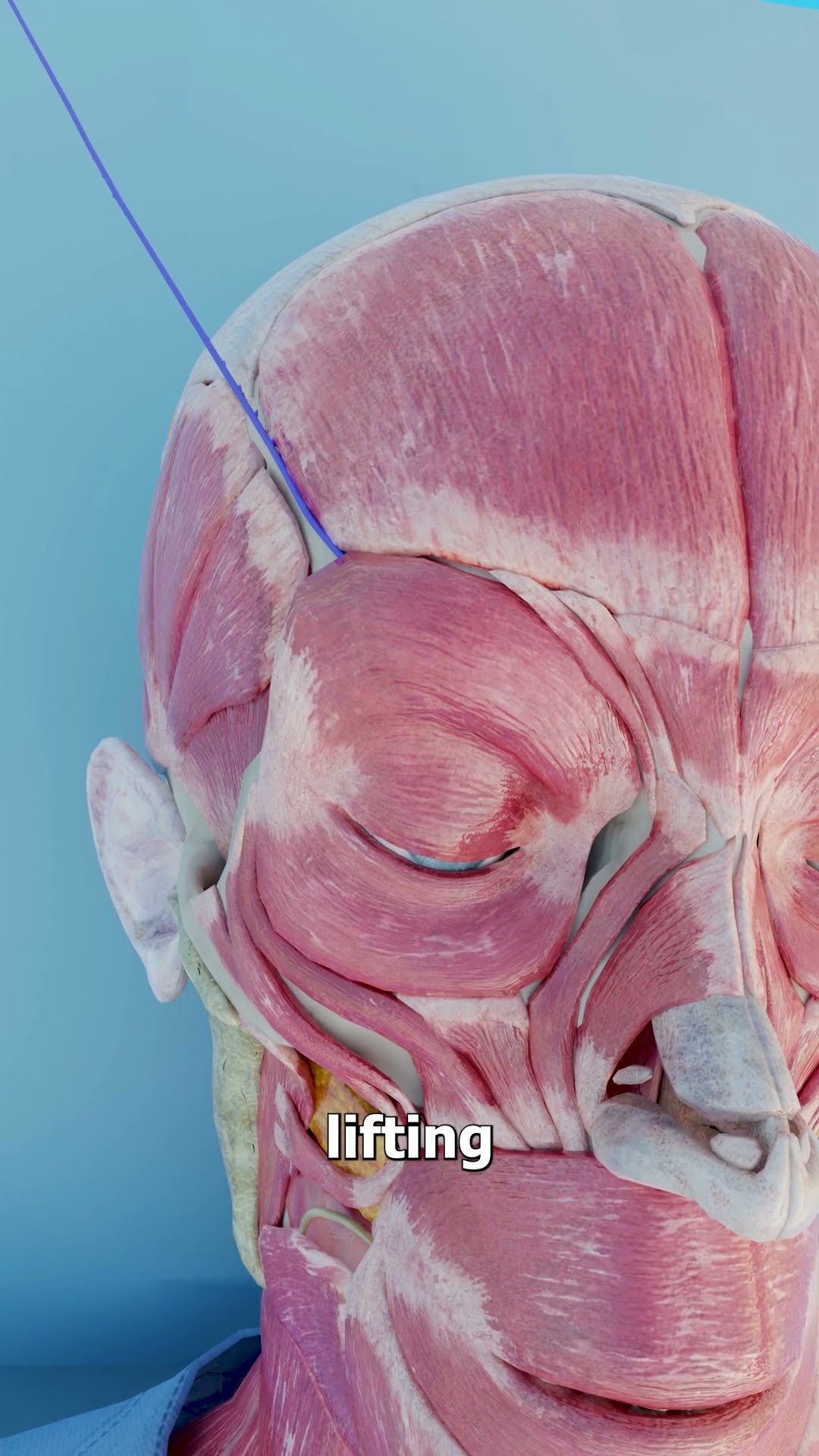 How An Eyebrow Thread Lift Works ?