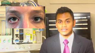 Eyelid pulled down after blepharoplasty |Denver Blepharoplasty Surgeon