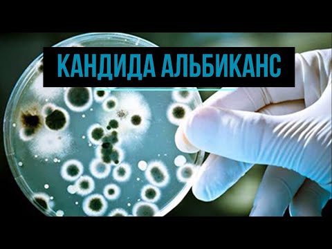 Кандида Альбиканс: причины возникновения, симптомы и методы лечения