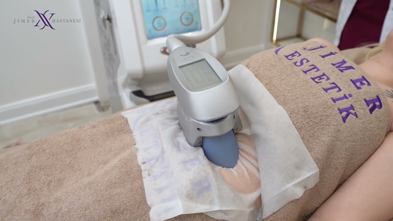 Soğuk Lipoliz Clatuu 360 -  Bölgesel Yağları Dondur ve Yok Et ! - Tek seansta zayıflama!