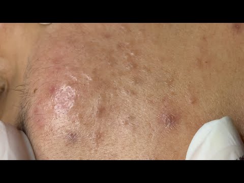 Satisfying Relaxing #ThuyTruong758