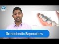 Orthodontic Separators/Spacers - What they are, and TIPS.