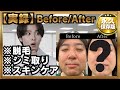 【1年間ガチ検証】肌検証した結果がすごい　かんたんメソッドで誰でも変われる