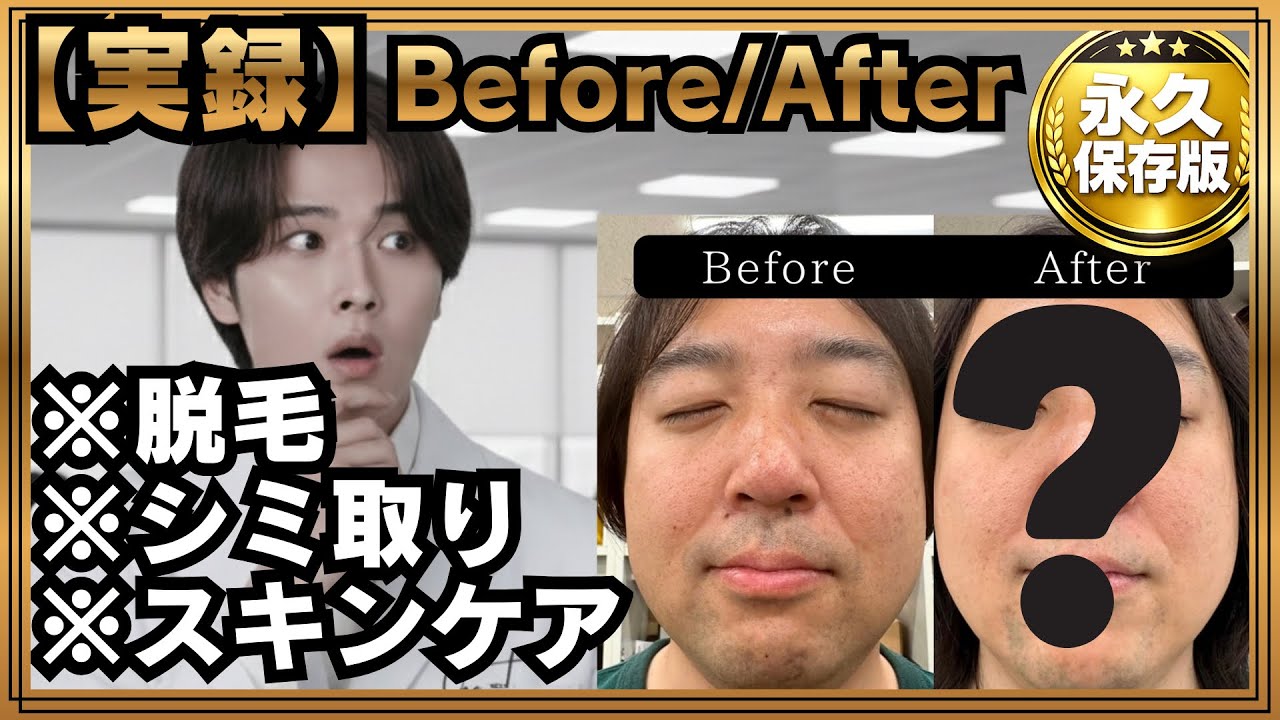 としくん One-year serious test] Amazing results from skin testing! Anyone
