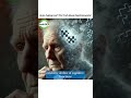 Are you forgetting things? The shocking link between rapid dementia and this deadly brain disease!